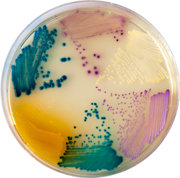 Base para agar cromogénico patógenos tracto urinario Orientation CHROMagar™